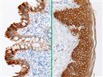 3235B | Control Slides:Immunopathology; Cytokeratin AE1/AE3